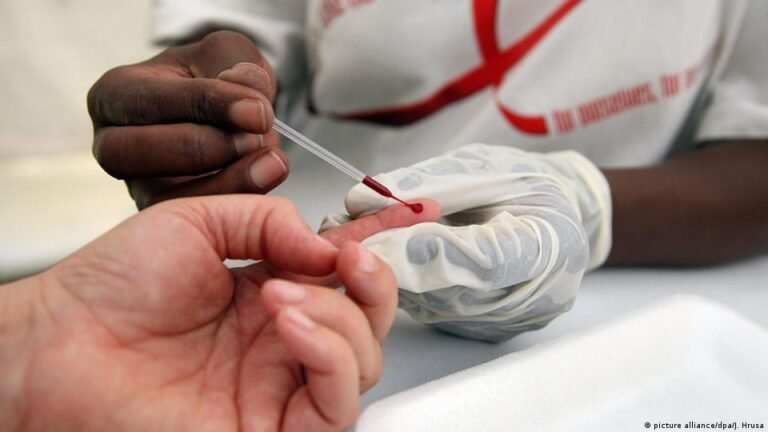 Why Is HIV Testing Important?